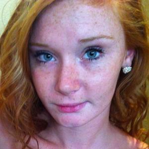 Profilbild von Sommersprosse98