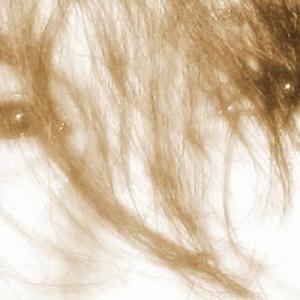 Profilbild von Hungryeyes